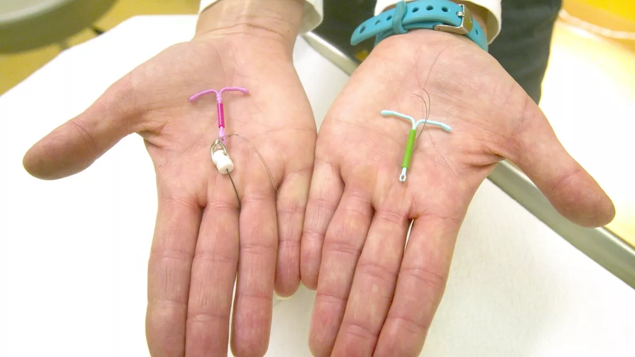 How gynecologists and patients can manage pain from IUD insertion