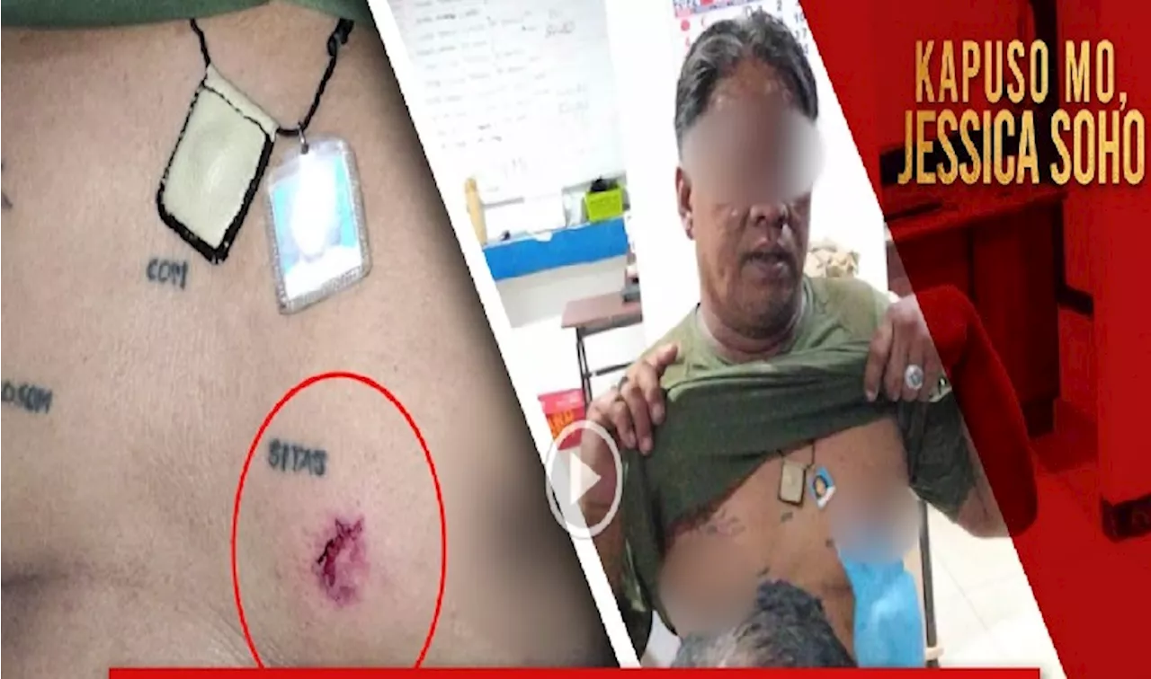 Tanod sa Cebu na binaril sa dibdib, hindi raw tinablan ng bala dahil sa anting-anting?