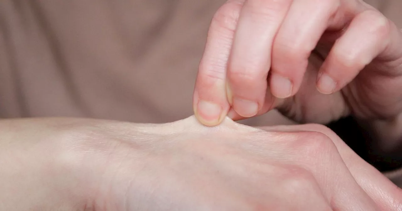 Simple test that will tell you whether you're losing collagen
