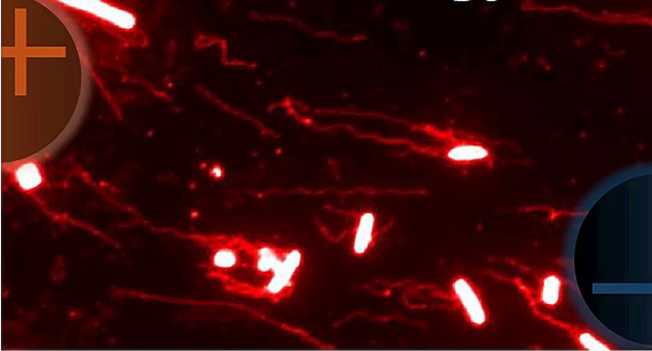 Study discovers an electric current in the gut that attracts pathogens like Salmonella