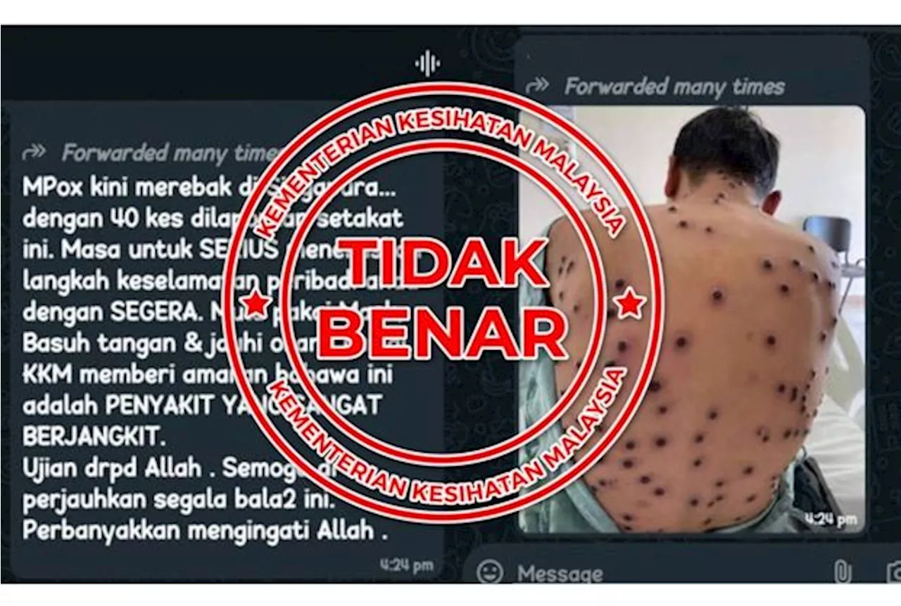 QuickCheck: Is there an mpox outbreak in Singapore?