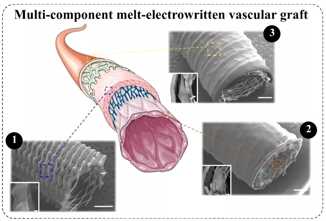 Bioengineers develop hybrid grafts to combat cardiovascular disease