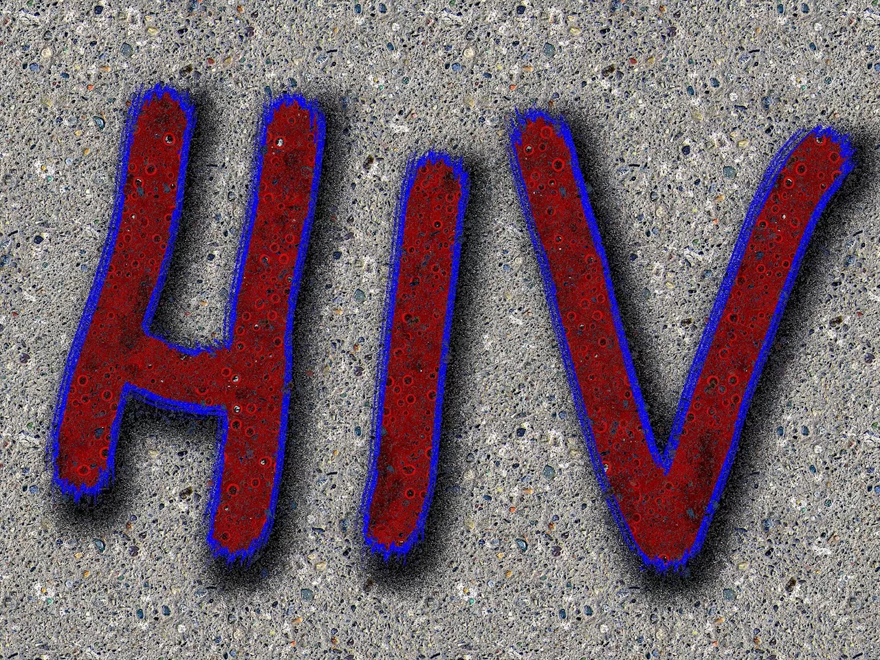 Cautious optimism in San Francisco as new cases of HIV in Latinos decrease