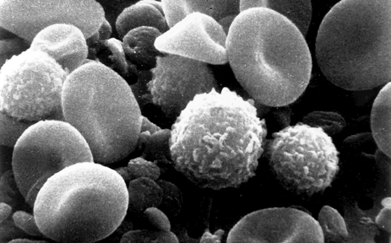 Immune cells have a metabolic backup plan for accessing their anti-cancer playbook