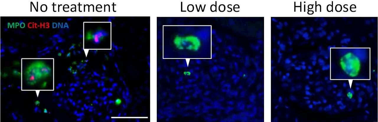 New compound shows great potential for patients with neutrophil-associated inflammation