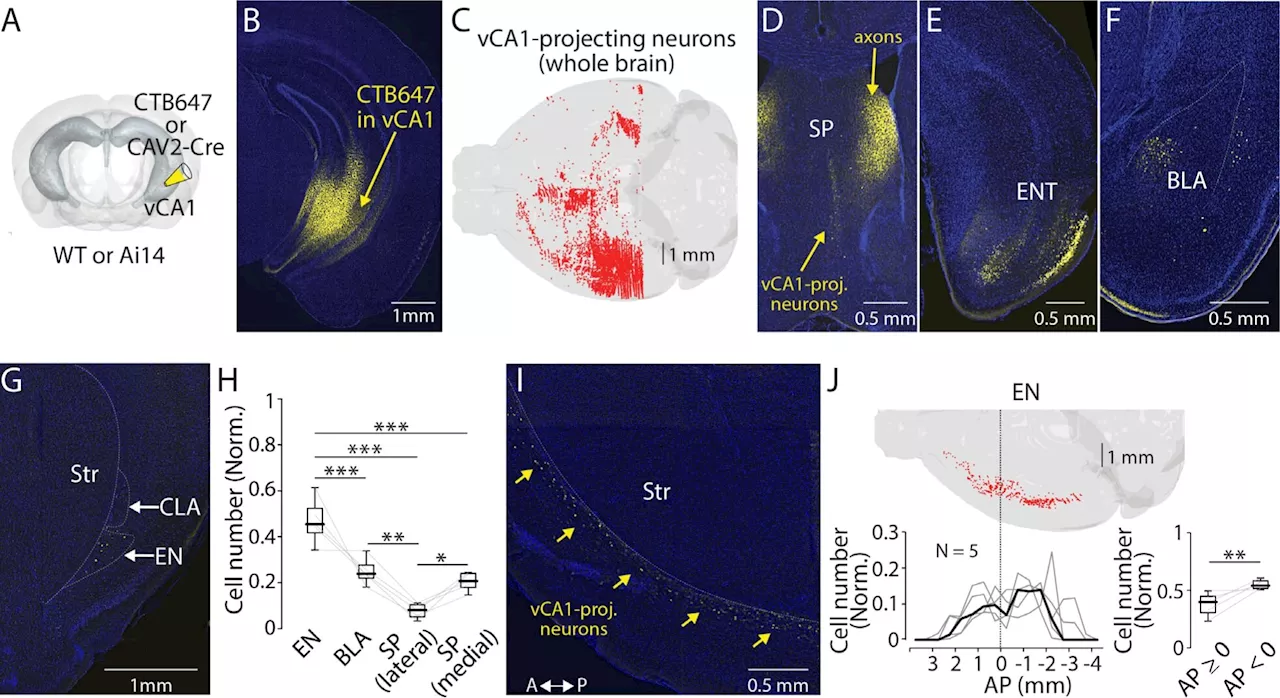 Researchers discover brain circuit that controls ability to recall information and memories