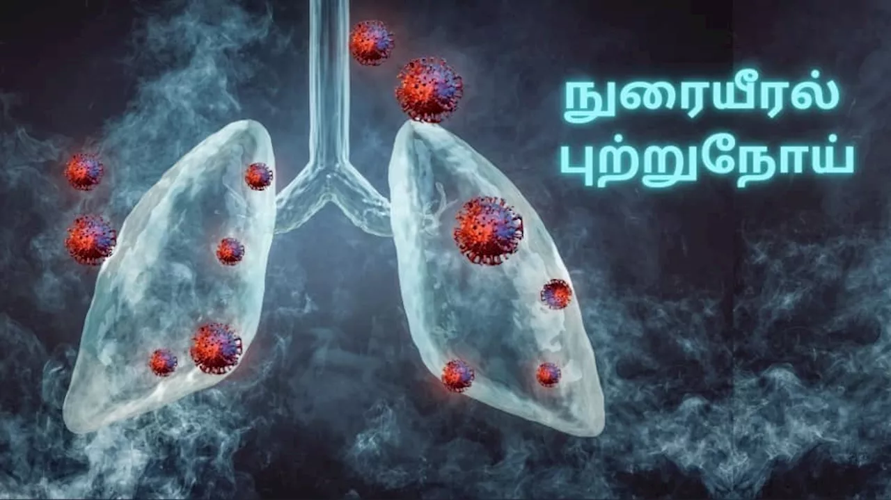 எச்சரிக்கை... நுரையீரல் புற்றுநோய் இருப்பதற்கான சில அறிகுறிகள்... அலட்சியம் வேண்டாம்