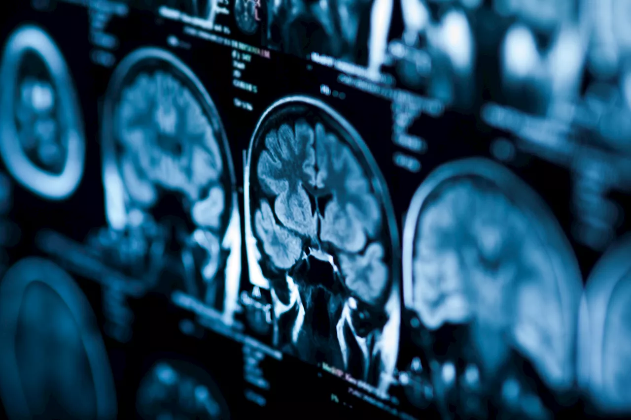 Scientists uncovered a bizarre way that our brains are mutating