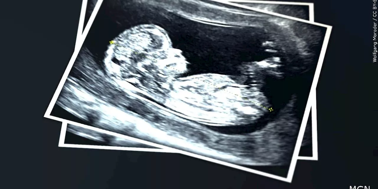 Judge blocks 24-hour waiting period for abortions in Ohio, citing 2023 reproductive rights amendment