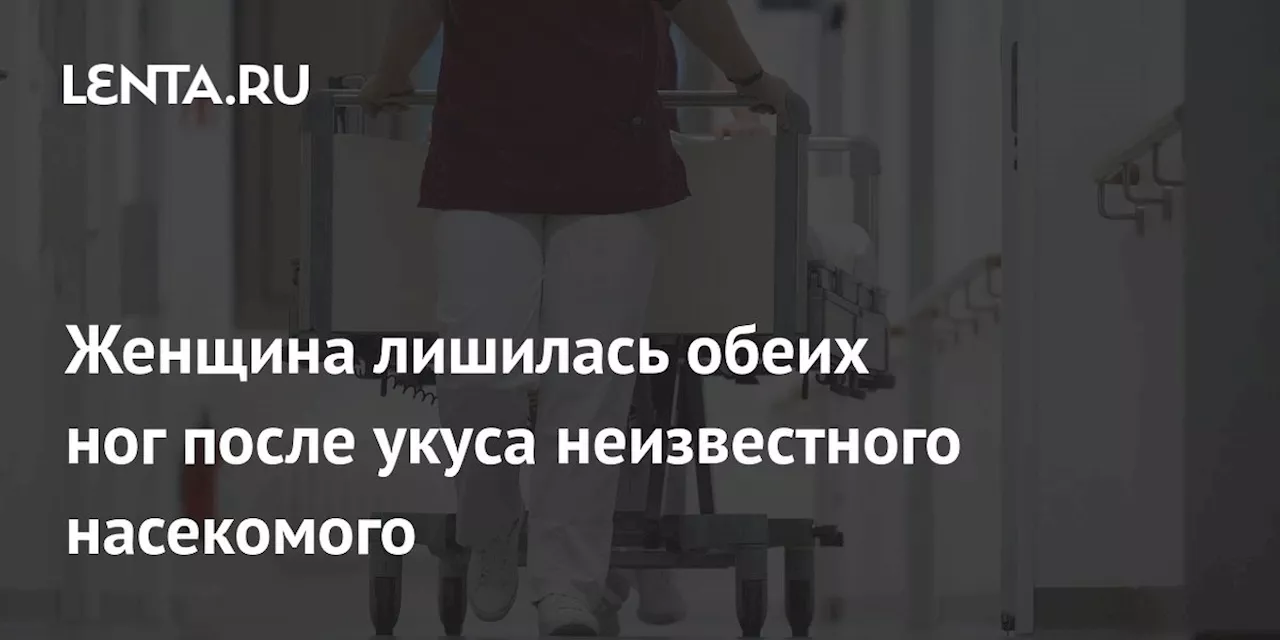 Женщина лишилась обеих ног после укуса неизвестного насекомого