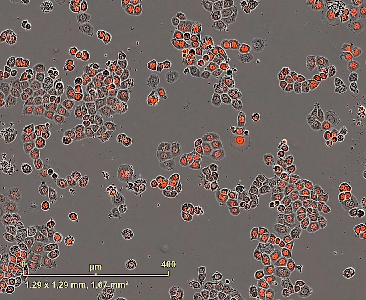 Cancer researchers develop new method that uses internal clock inside tumor cells to optimize therapies