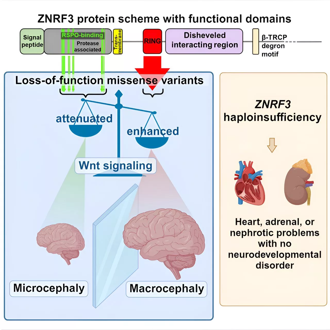 Faulty gene makes the brain too big—or too small