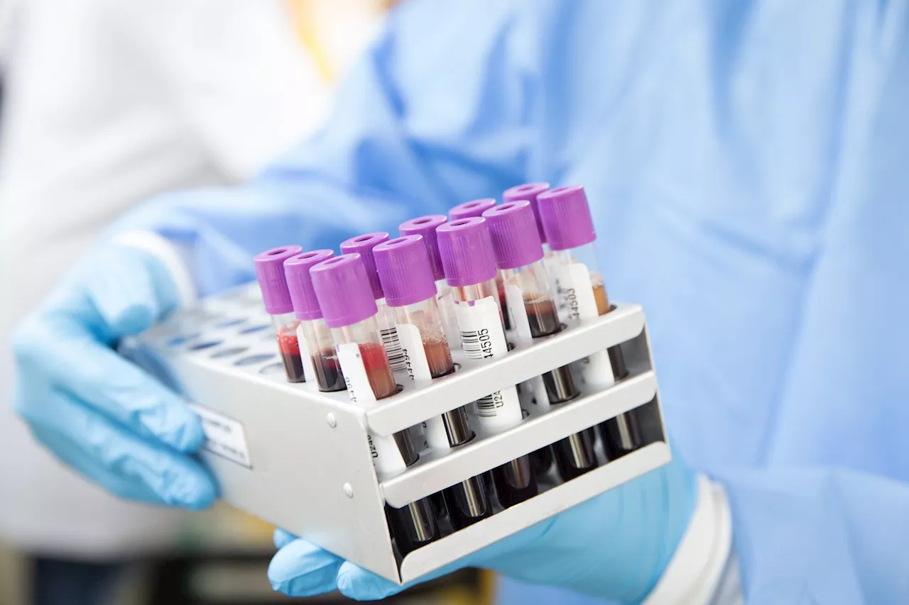 Simple blood test for Alzheimer's disease could change how the disease is detected and diagnosed