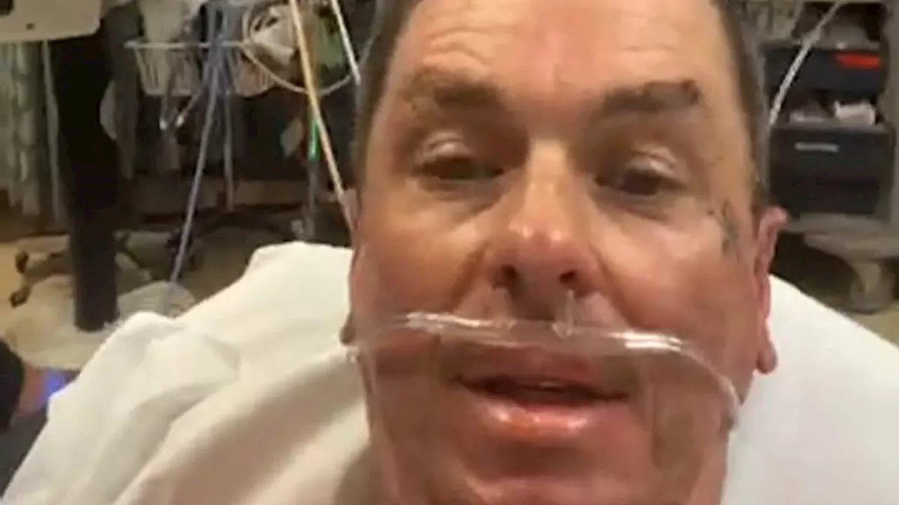 Slipknot's Sid Wilson hospitalized with serious burns after fire explosion on farm he shares with...