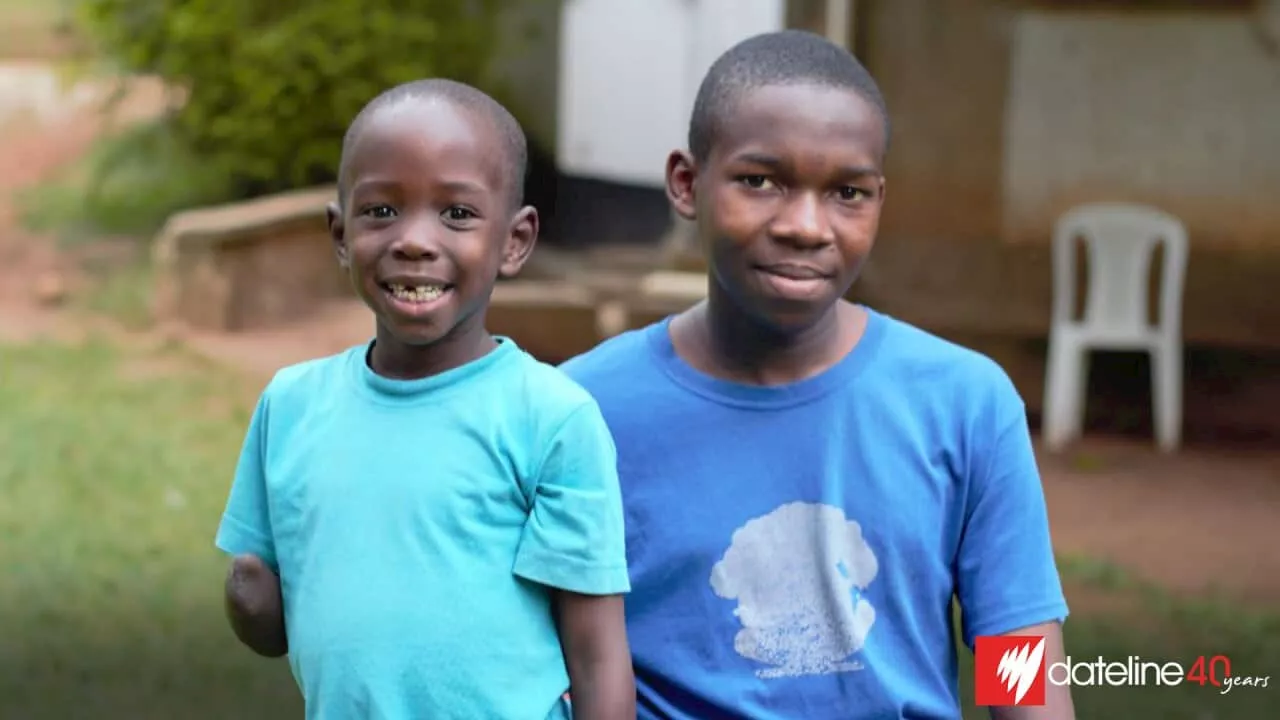 Jessy and George were mutilated by witch doctors. Now Australian doctors are restoring their health