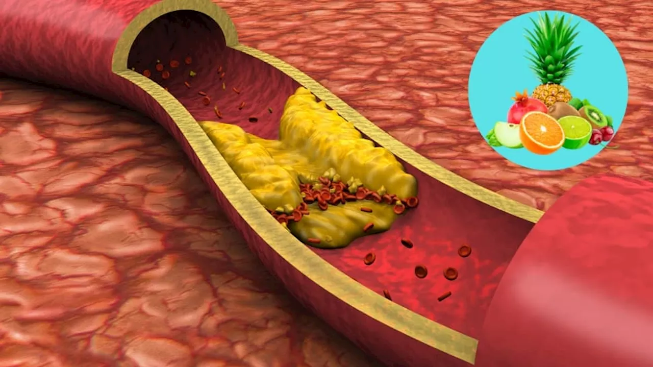 மாரடைப்பு அபாயம் நீங்க... கொலஸ்ட்ராலை எரிக்கும் ஆற்றல் கொண்ட பழங்கள்...