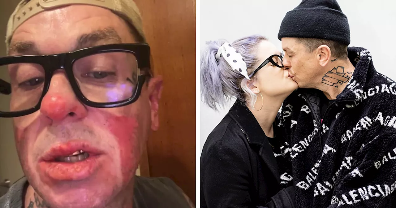 Kelly Osbourne Issues Warning After Boyfriend, Slipknot's Sid Wilson, “Set Himself On Fire”