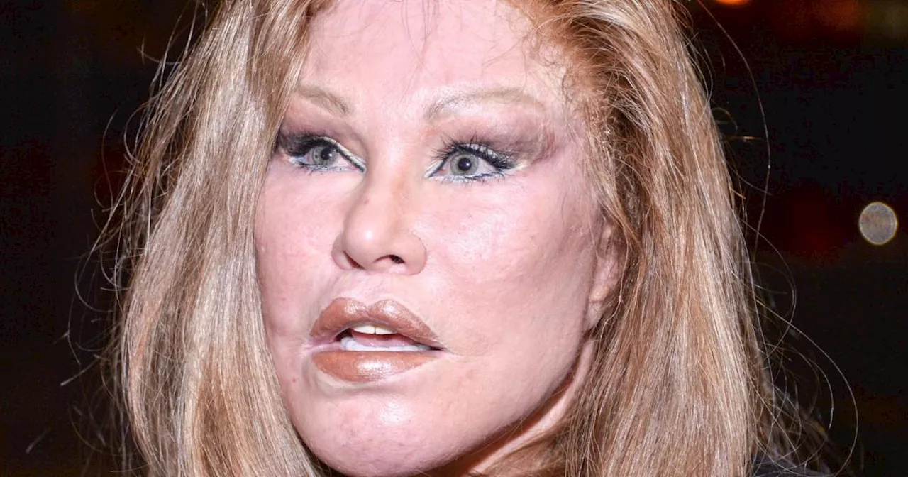 'Catwoman' Jocelyn Wildenstein enthüllt ihr ursprüngliches Gesicht