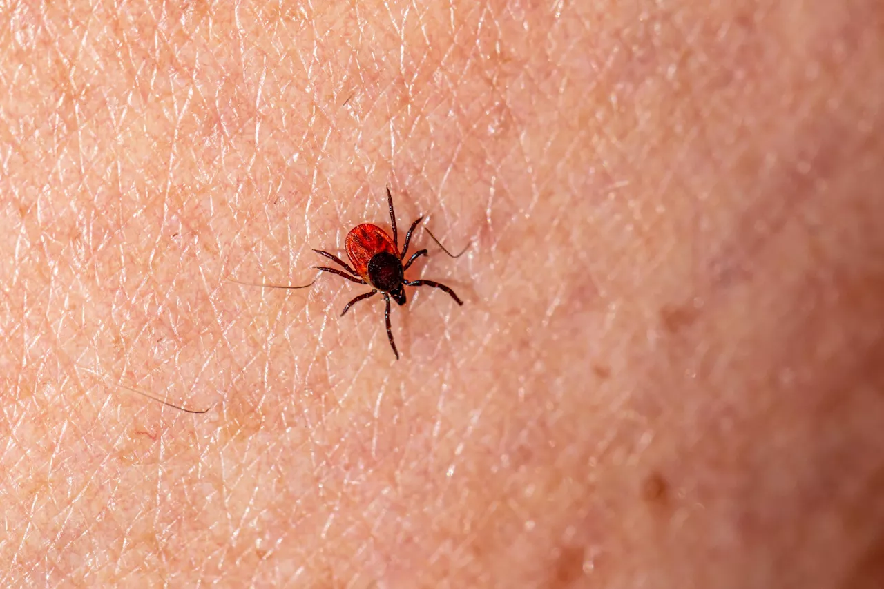 A case of tick-borne Powassan virus in a child