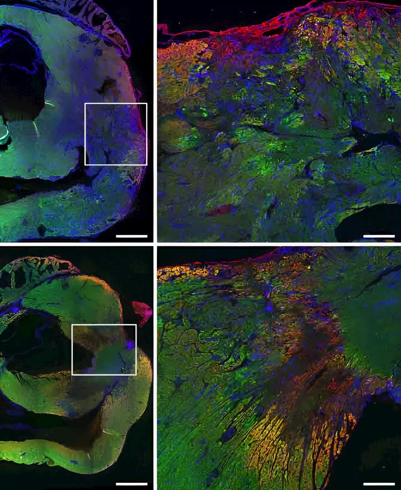 Research team discovers how Copaxone protects the heart muscle and improves its function after heart attack