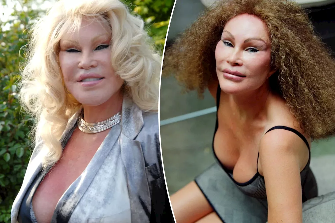 Socialite Jocelyn Wildenstein, known as 'Catwoman,' reveals pre-plastic surgery face in shocking throwback photo