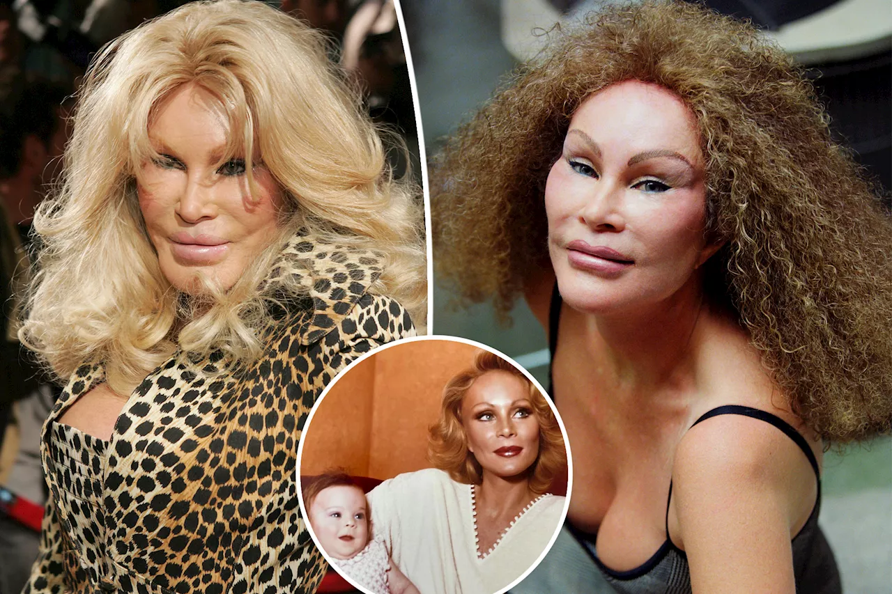 'Catwoman' Jocelyn Wildenstein reveals her original face in shocking throwback photo