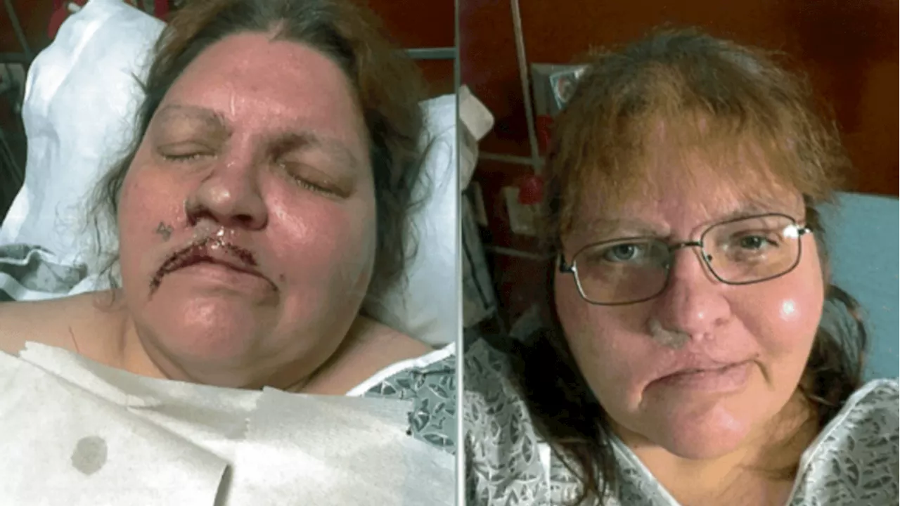 Woman disfigured by 'unnecessary' surgery awarded $3.45 million in Tennessee