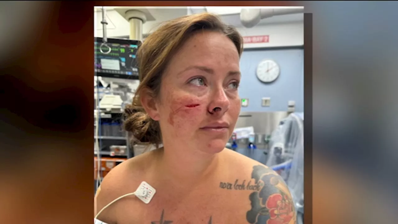 Woman details horror of random knife attack on face at Newark Airport terminal