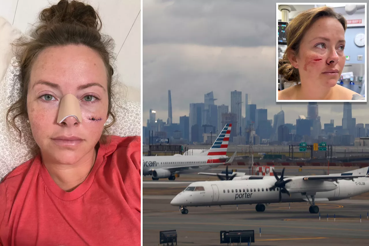 Homeless repeat offender stabs North Carolina tourist across cheek at Newark Airport: cops