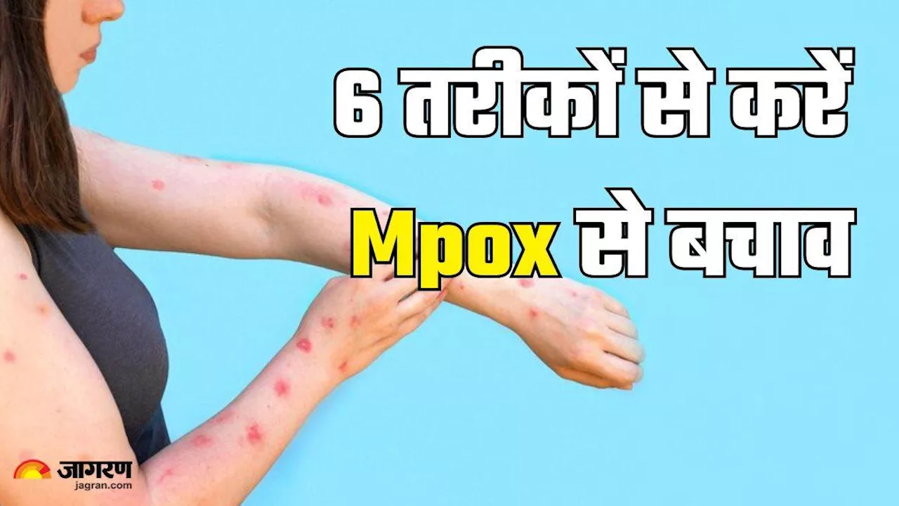 पूरी दुनिया में तेजी पैर पसार रहा Mpox, आपके घर पर दे दस्तक इससे पहले बचाव के लिए अपनाएं ये 6 तरीके