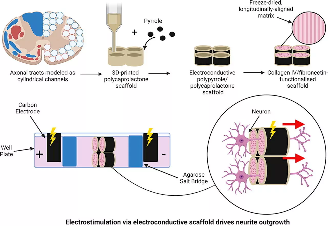 Researchers develop new implant to power healing after spinal cord injury