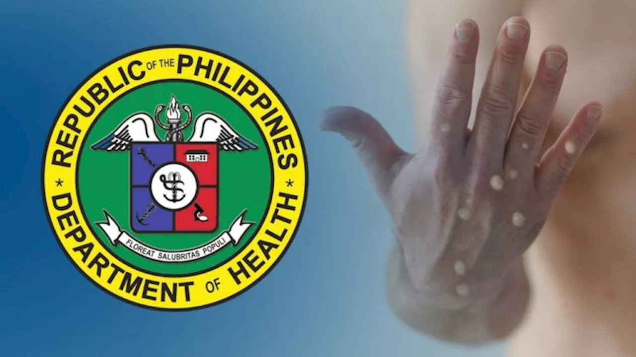 Two new mpox cases reported in Philippines; total rises to 14