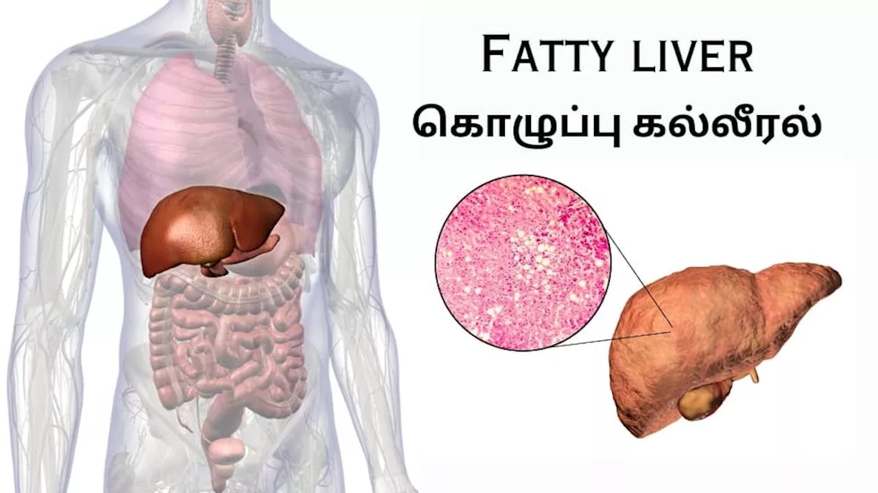 Fatty Liver... கல்லீரலை காலி செய்யும் சில ஆபத்தான உணவுகள்...