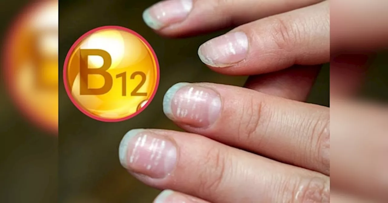 Vitamin B12 Deficiency: विटामिन B12 की कमी होने पर नाखूनों से इस तरह मिलते हैं संकेत, इग्नोर किया तो शरीर हो जाएगा खोखला!