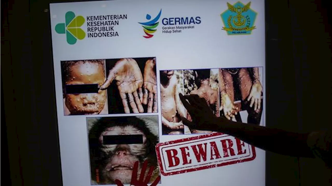 Daftar 5 Kelompok Berisiko yang Bakal Diberi Vaksin Mpox Duluan