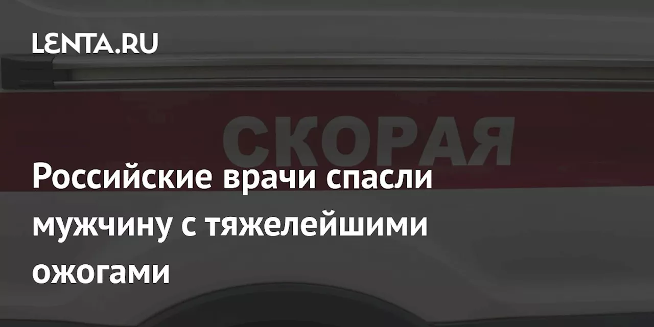 Российские врачи спасли мужчину с тяжелейшими ожогами