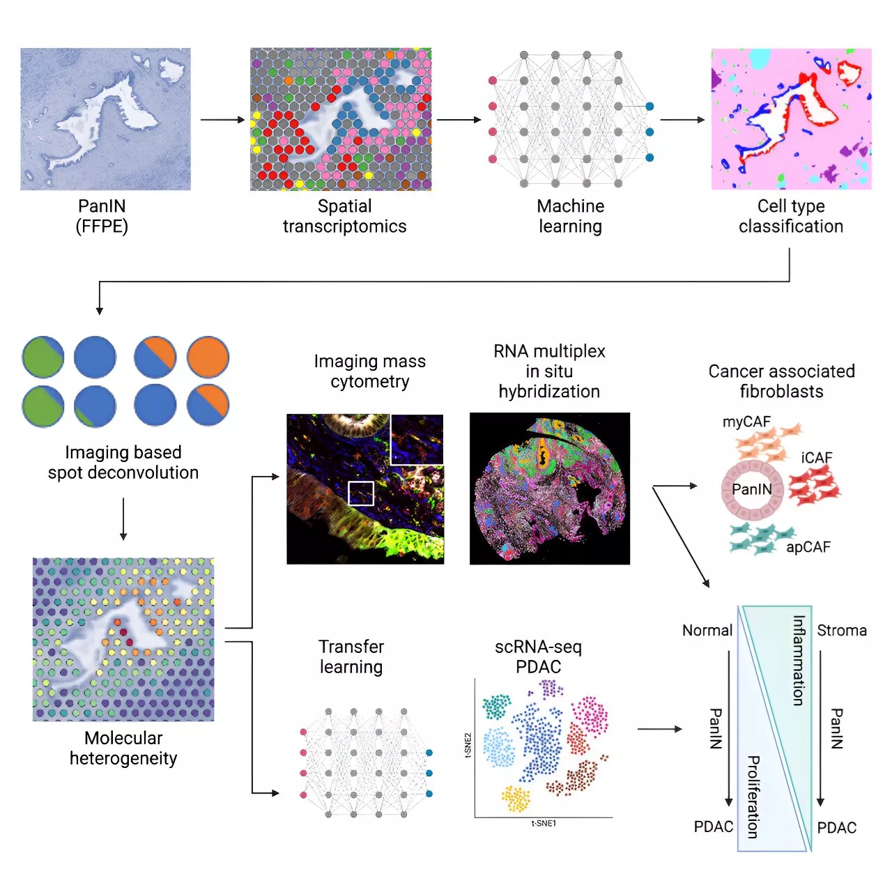 Identifying key markers in pancreatic cancer progression using a new analysis pipeline