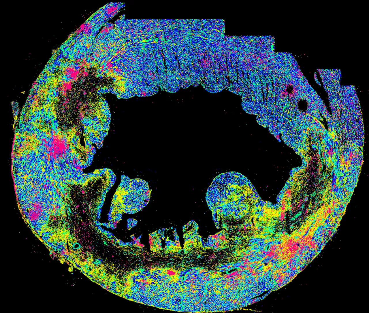 Mechanical stress in the borderzone: A new source of cardiac inflammation