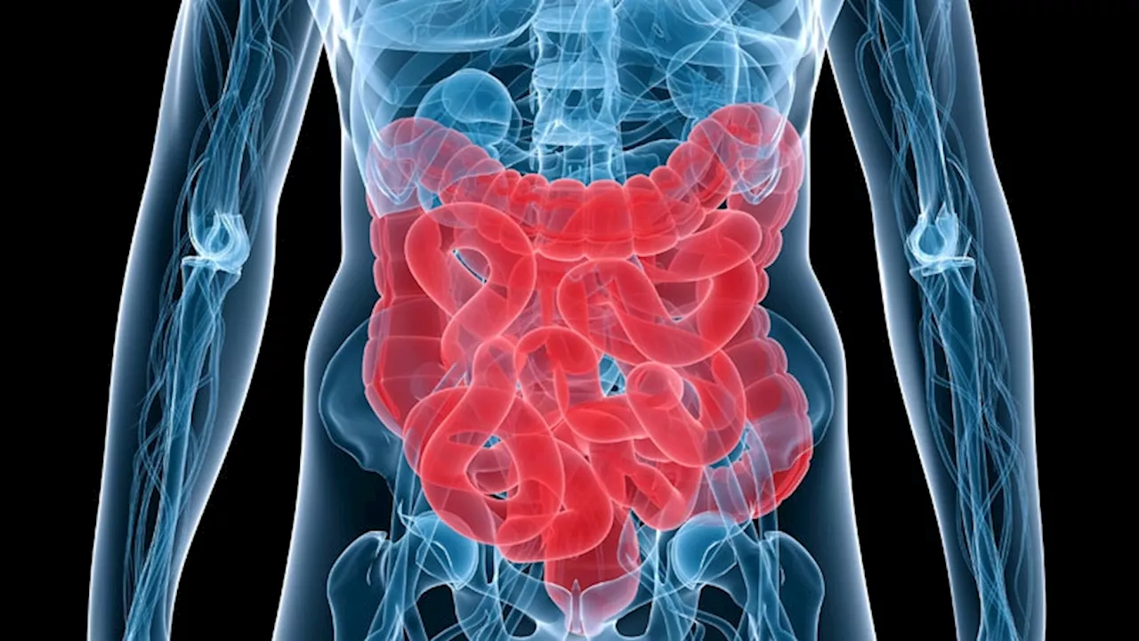 New Associations Identified Between IBD and Extraintestinal Manifestations