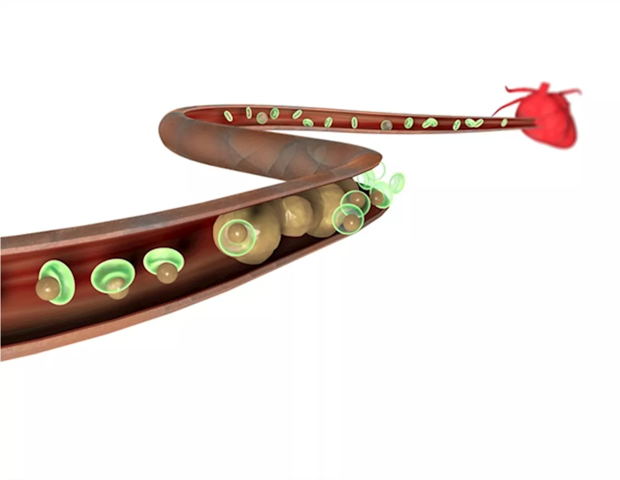 Routine lipoprotein(a) testing recommended for all adults