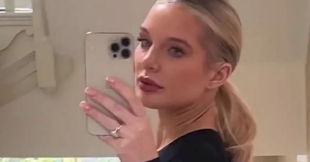 Helen Flanagan fans say she's wearing dress backwards as she shows £5k boob job