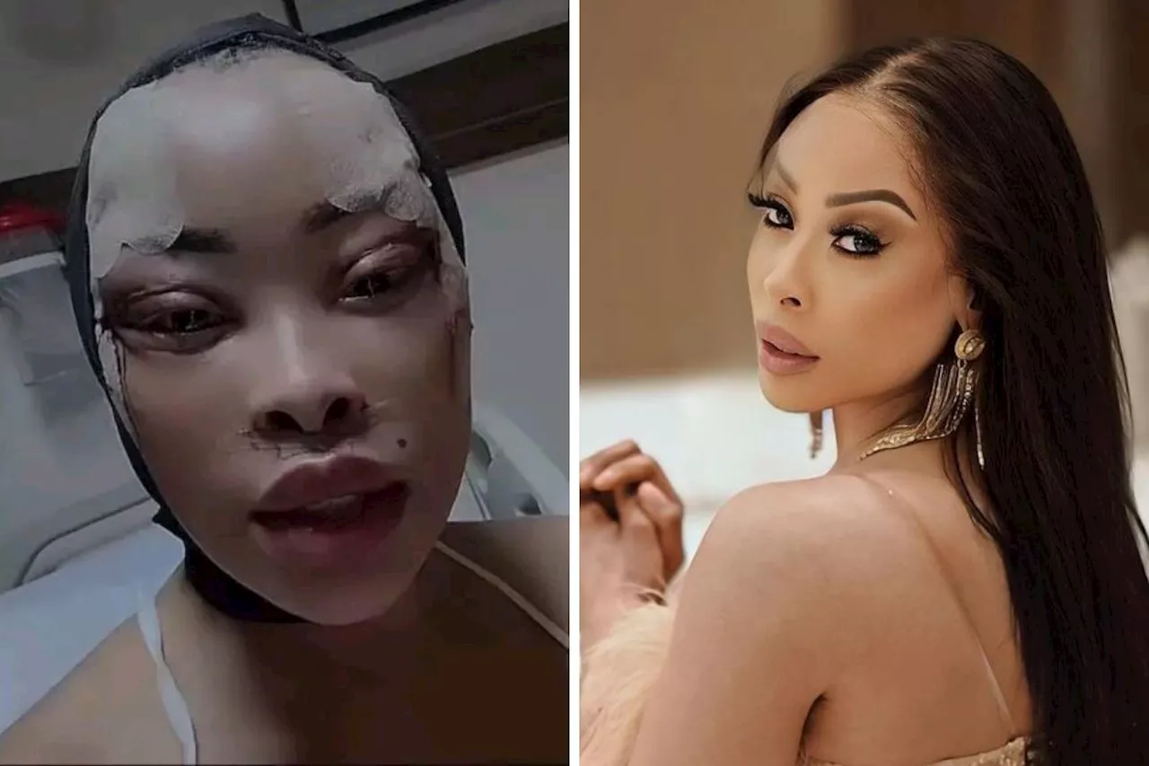 ‘Still recovering’: Khanyi Mbau goes under the knife for a new face [VIDEO]