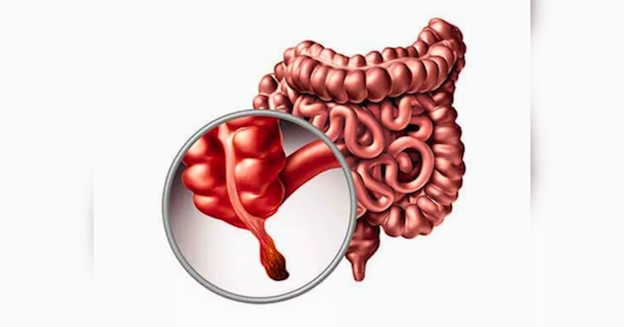 अपेंडिक्स में कैंसर की गांठ बनने पर दिखते हैं ये 5 लक्षण, इस उम्र के लोग ज्यादा रहे सतर्क, डॉ. ने दी चेतावनी