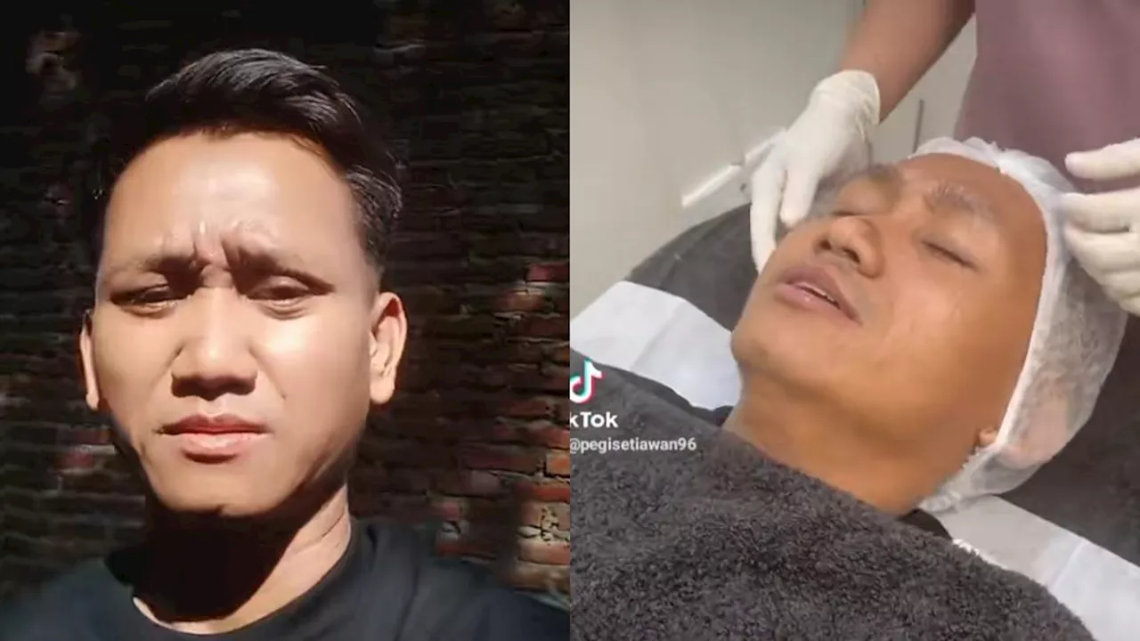 7 Potret Terbaru Pegi Setiawan Jadi Seleb Tiktok, Glowing Berkat Perawatan