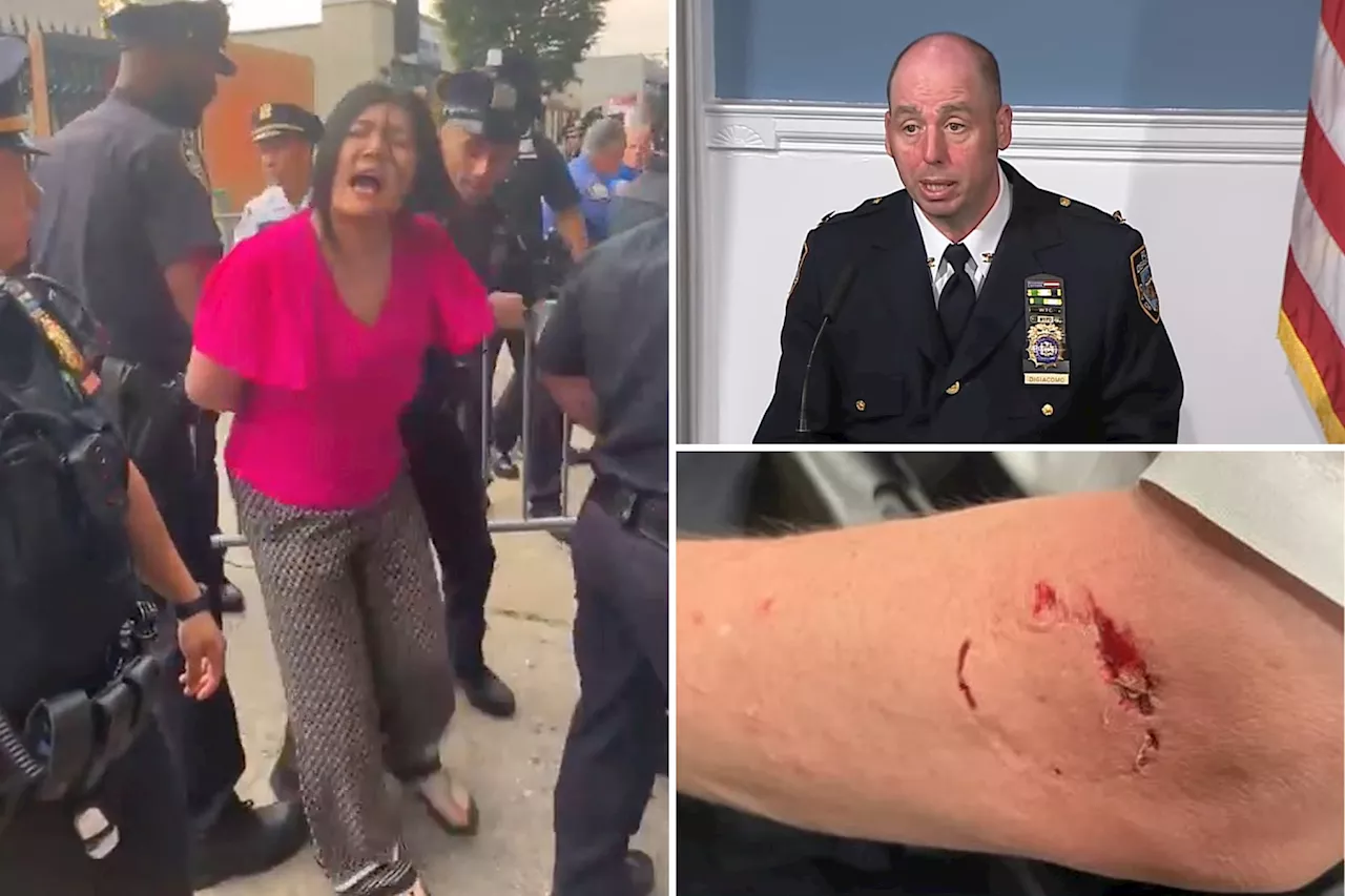 NYPD chief bitten by city councilwoman at protest 'pissed off' she's playing victim, says pol's lying about being choked