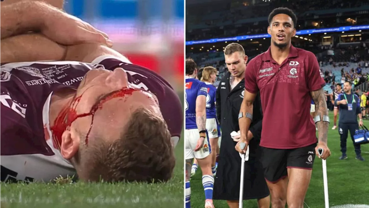 Manly address concerns over Tom Trbojevic’s injured shoulder