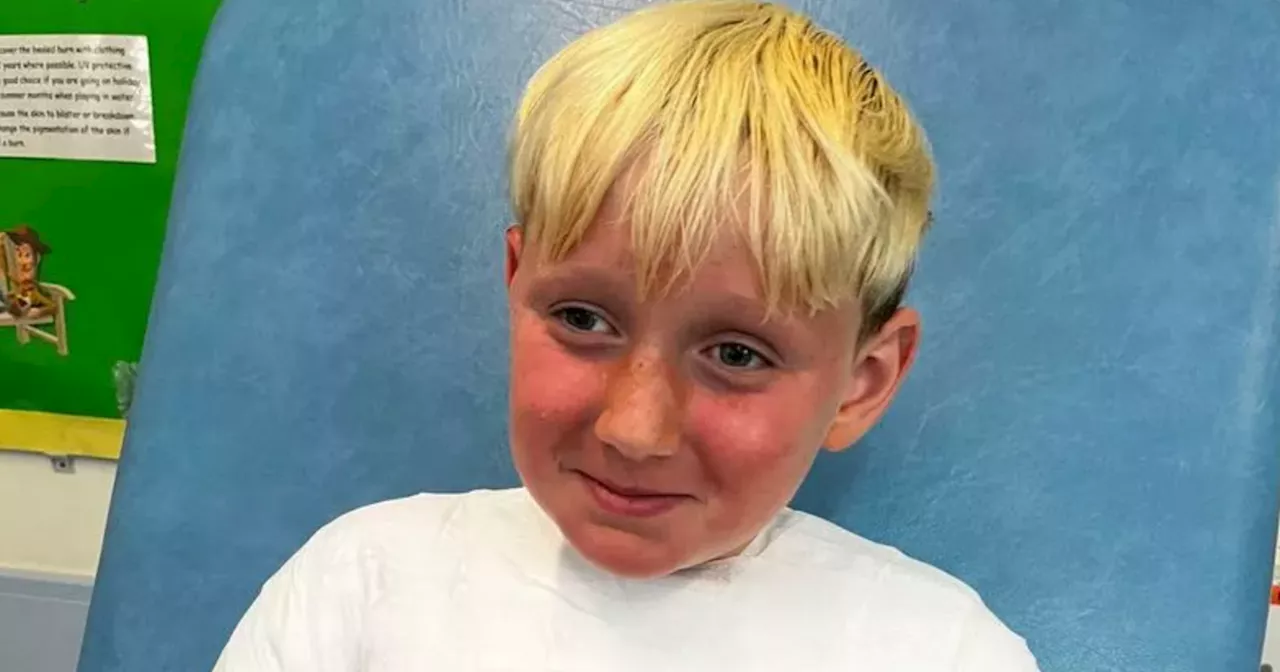 Mum's warning as son left needing surgery for sunburn after wearing factor 90