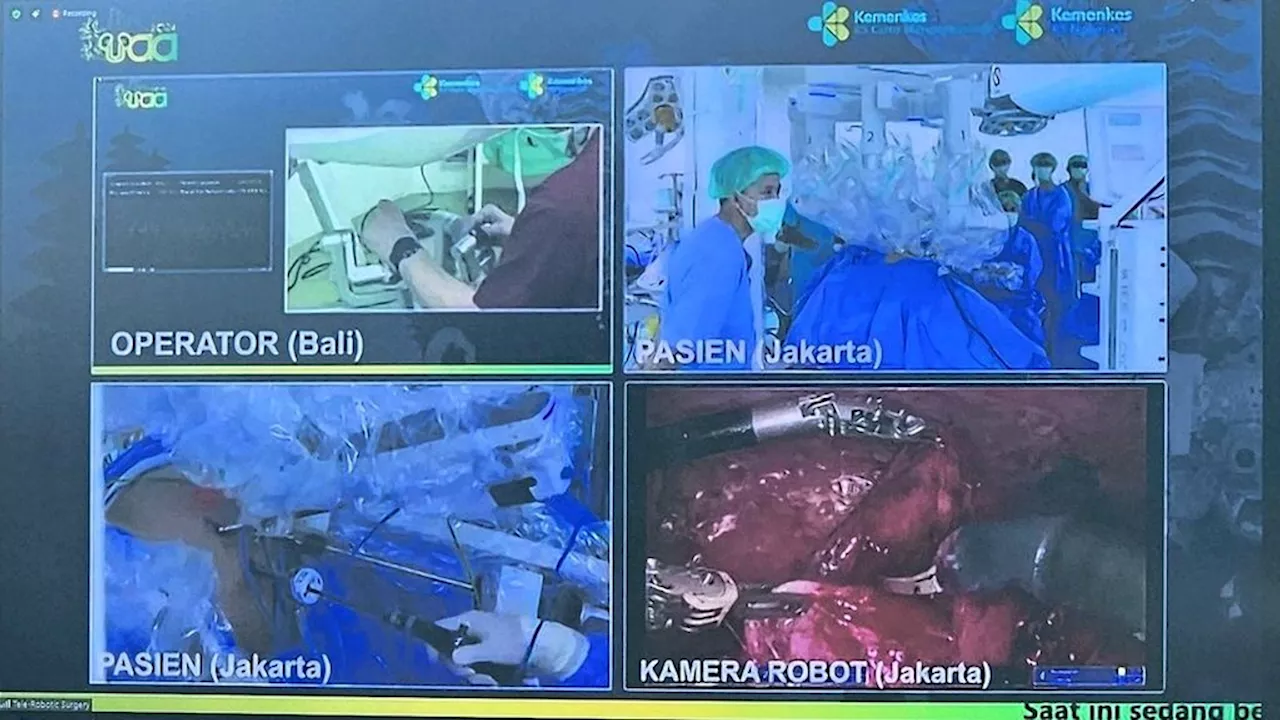 Pertama di Indonesia, Operasi Jarak Jauh dengan Robot Sukses Dilakukan pada Pasien Kista