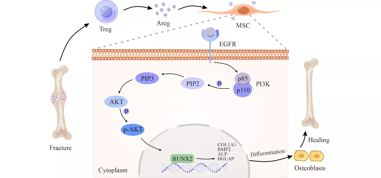 A distinct 'repair' role of regulatory T cells in fracture healing