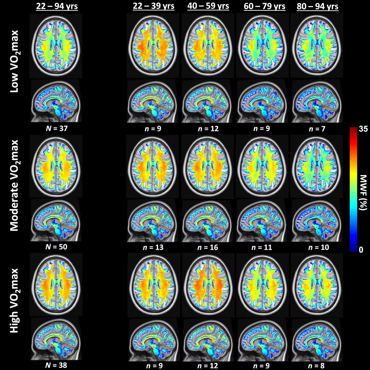 Brain training: Study links cardiovascular fitness to brain health